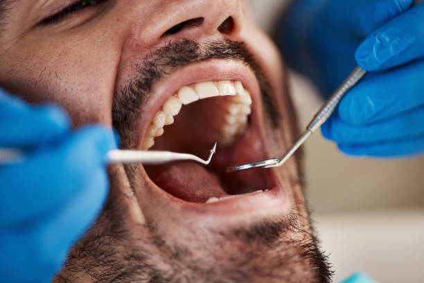 Best Emergency Dentist for Knocked-Out Tooth in Arcadia, FL